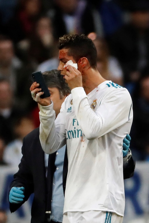 Zakrwawiony Ronaldo przegląda się w telefonie. Zdjęcia piłkarza Realu robią furorę